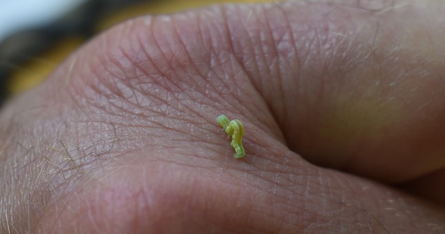 cankerworm on mans hand